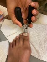 Alicate cortaúñas frontal más cureta limpiador de uña - Imagen 3