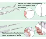 Set pedicura manicura limpieza uñas encarnadas con estuche - Imagen 4
